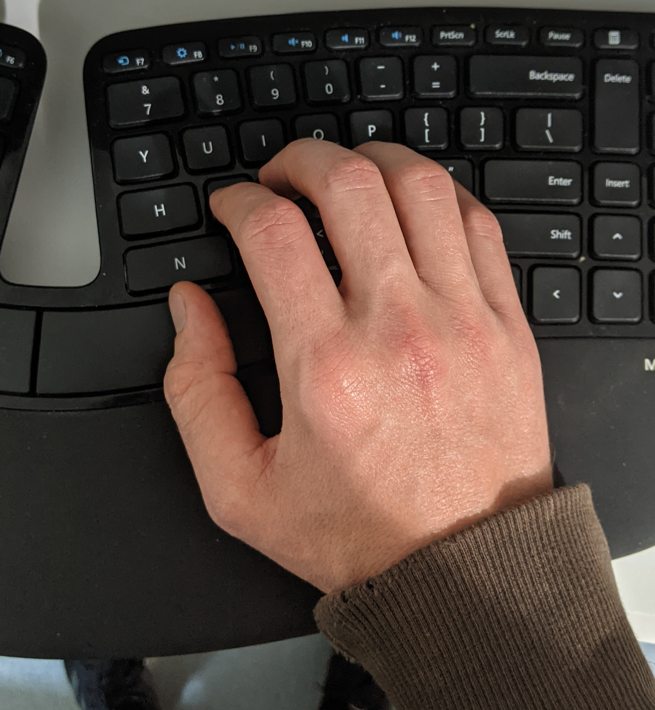 My hand in my natural typing position on the Microsoft Sculpt